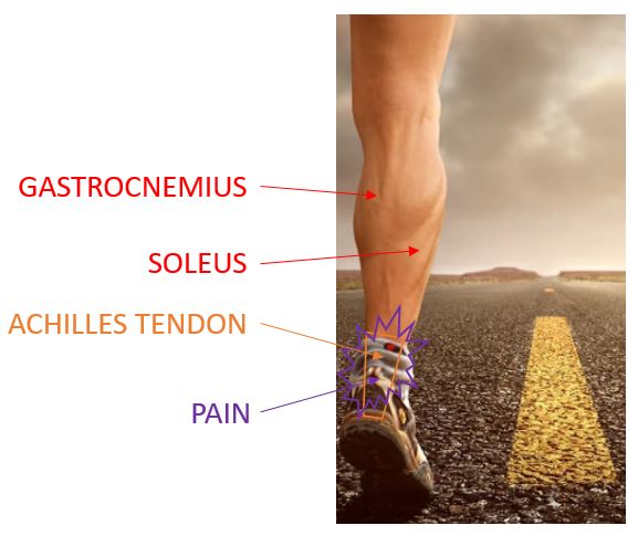 Achilles tendon orders after running