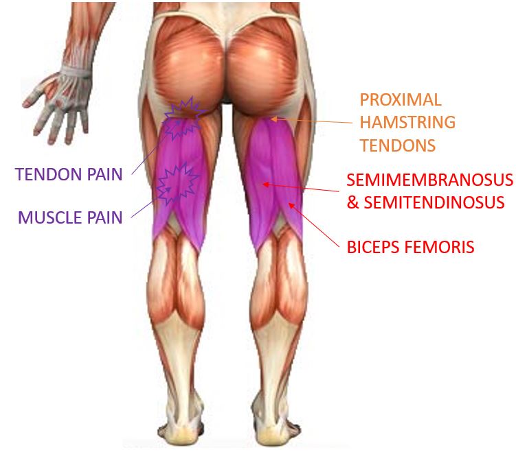 hamstring muscles and tendons, hamstring injury